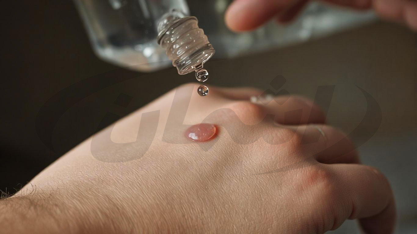 آیا استفاده از الکل طبی برای ضدعفونی و تمیز کردن زخم ایمن است؟ بررسی علمی و نکات مهم | اشمان