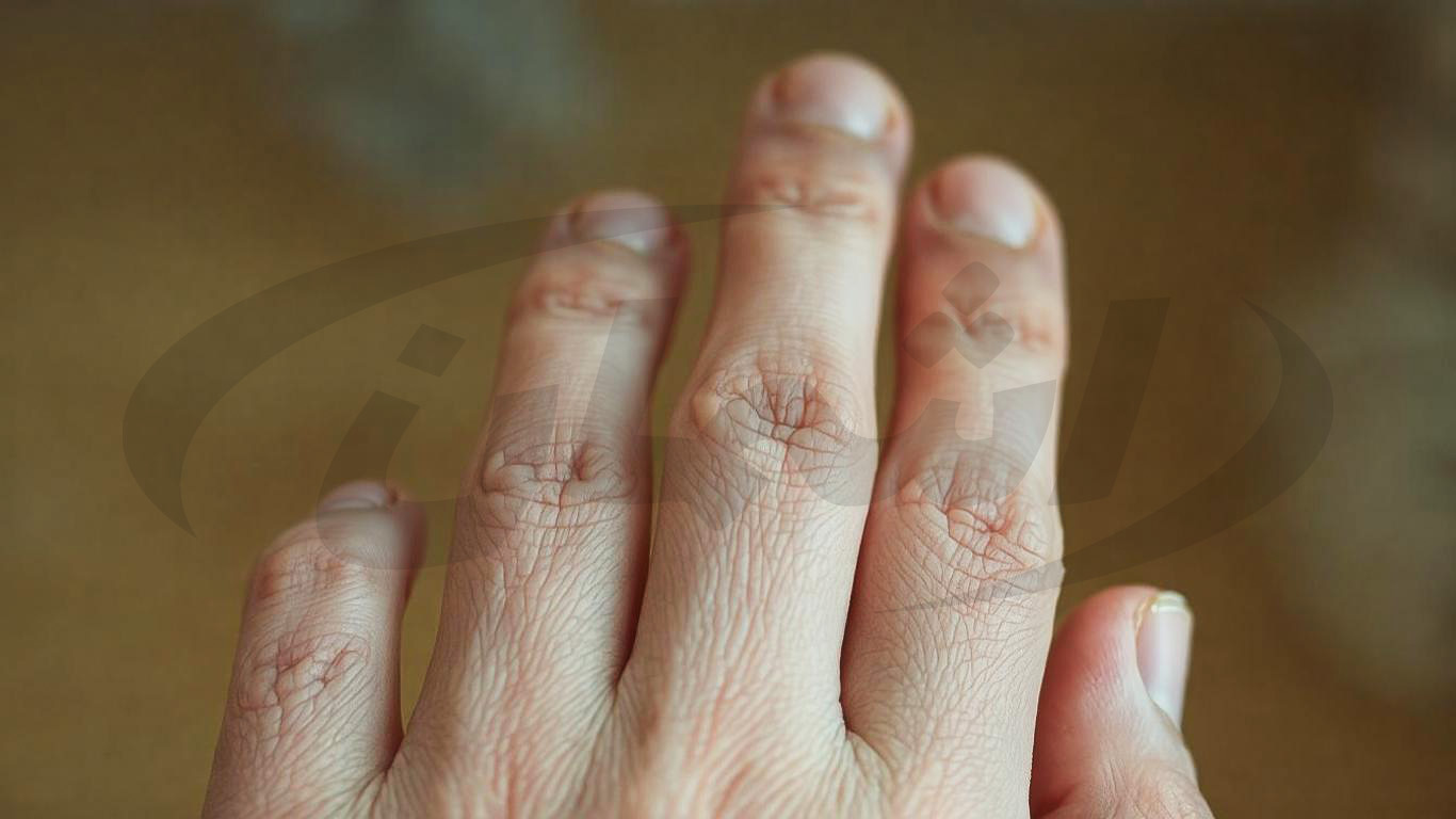 آیا استفاده زیاد از الکل به پوست آسیب می‌زند؟ | بررسی علمی اثر الکل بر پوست دست